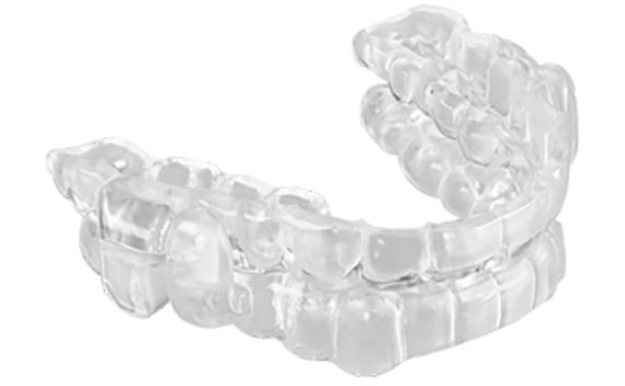 snore device | Serenity Valley Dental