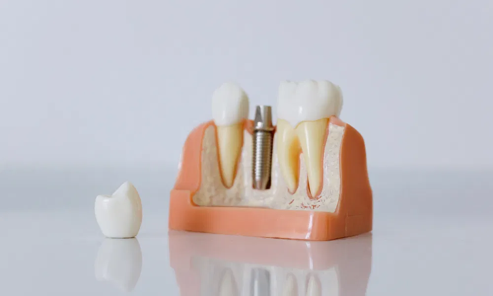 Kindred ND - Serenity Valley Family Dentistry
