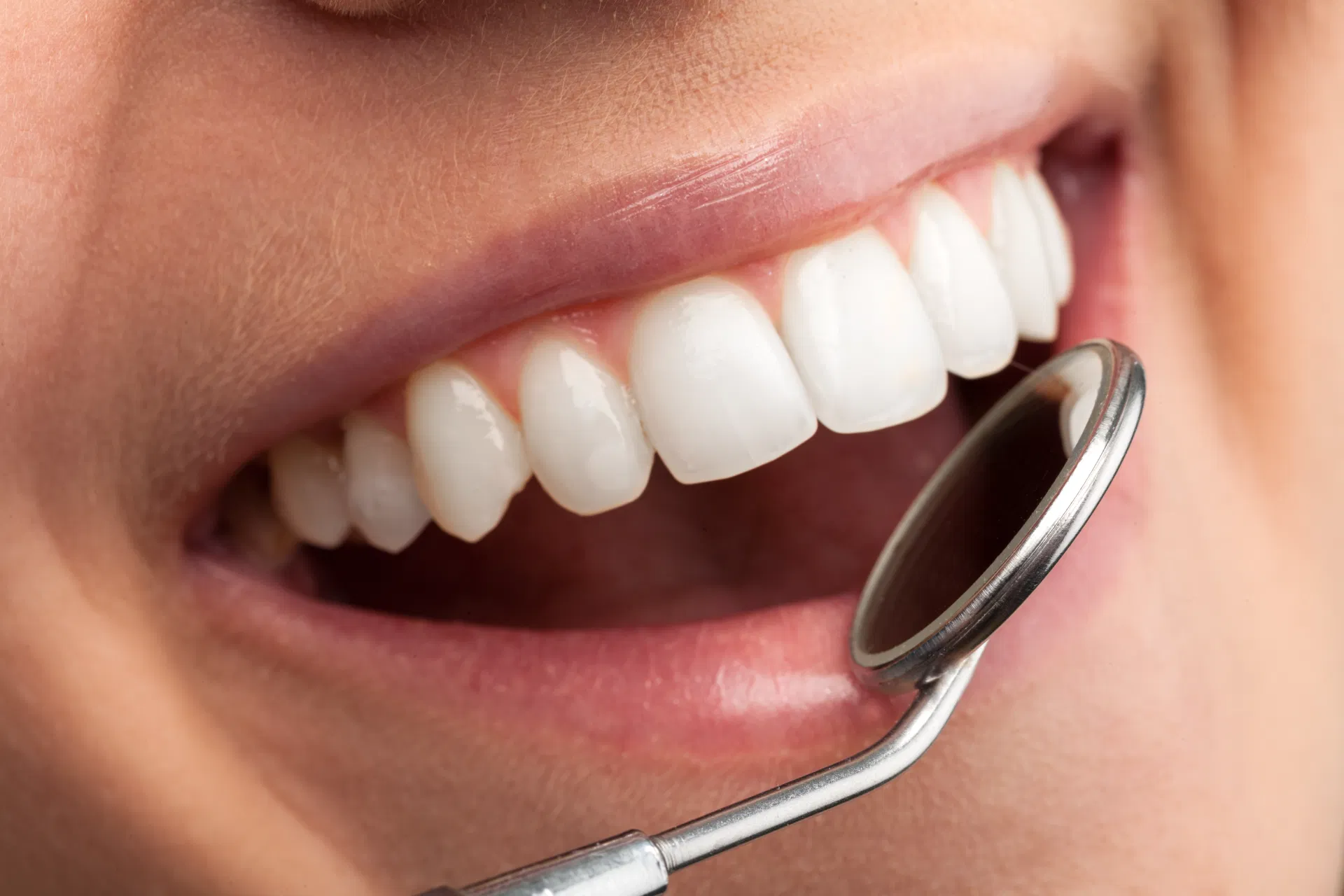 dental checkup