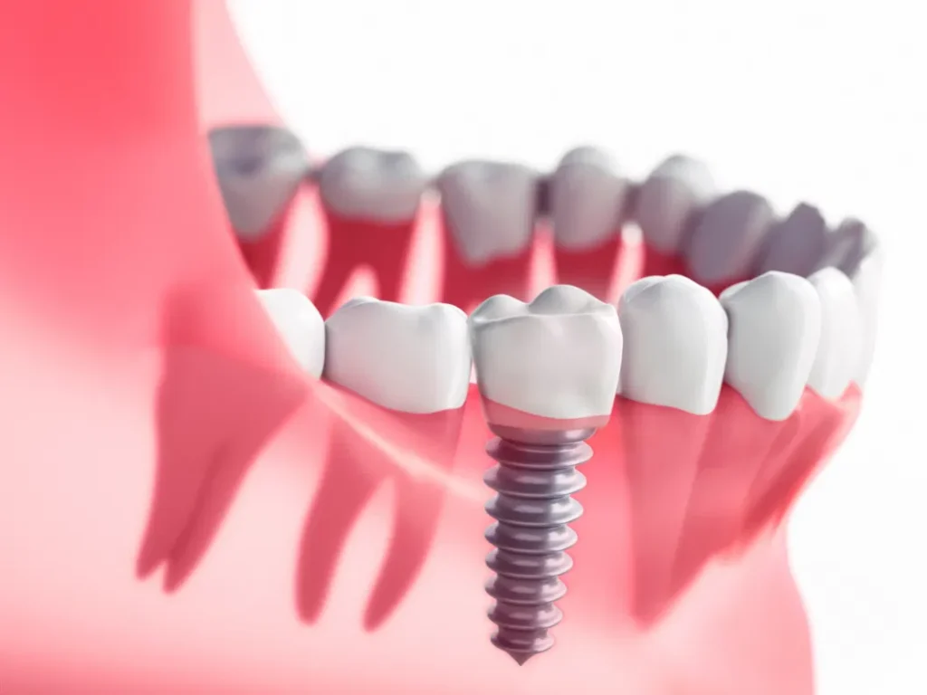 dentures