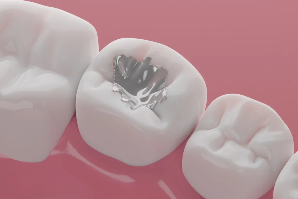 dental
